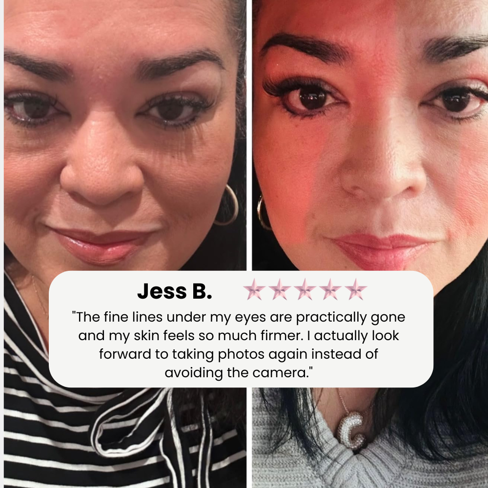 Klivora Revitalizing Under Eye Balm for Dark Circles, Puffiness & Fine Lines