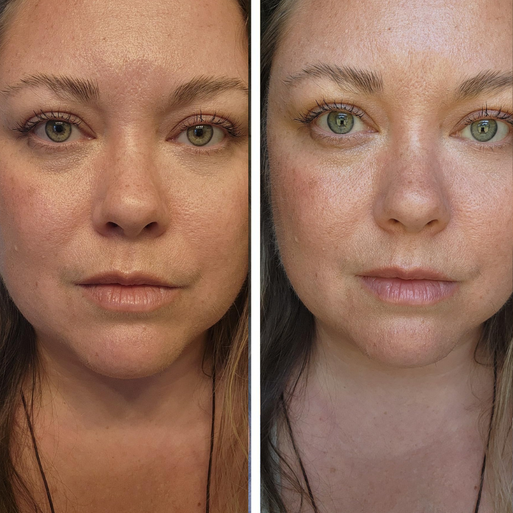 Advanced Volufiline Deep Collagen Serum for Face: Firming, Hydrating, Youthful Glow