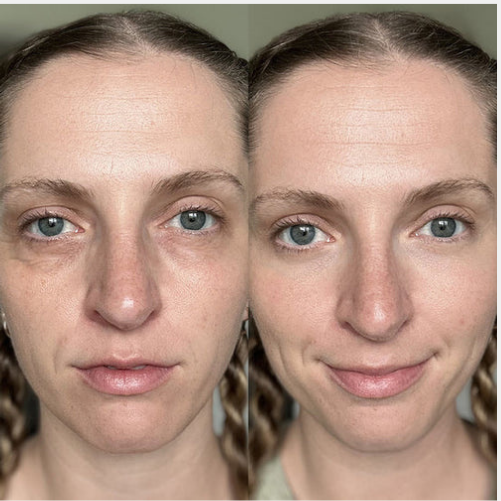 Klivora Revitalizing Under Eye Balm for Dark Circles, Puffiness & Fine Lines