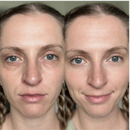 Klivora Revitalizing Under Eye Balm for Dark Circles, Puffiness & Fine Lines