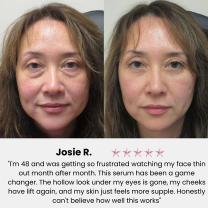 Advanced Volufiline Deep Collagen Serum for Face: Firming, Hydrating, Youthful Glow