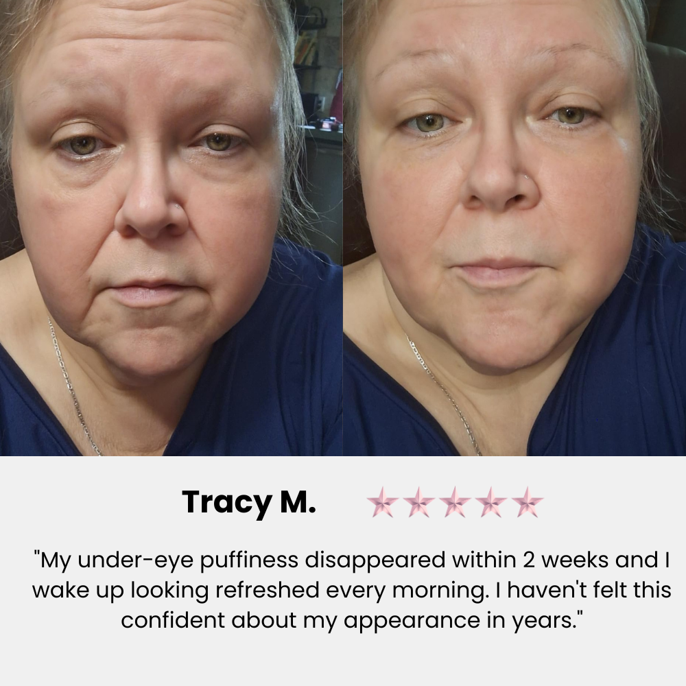 Klivora Revitalizing Under Eye Balm for Dark Circles, Puffiness & Fine Lines