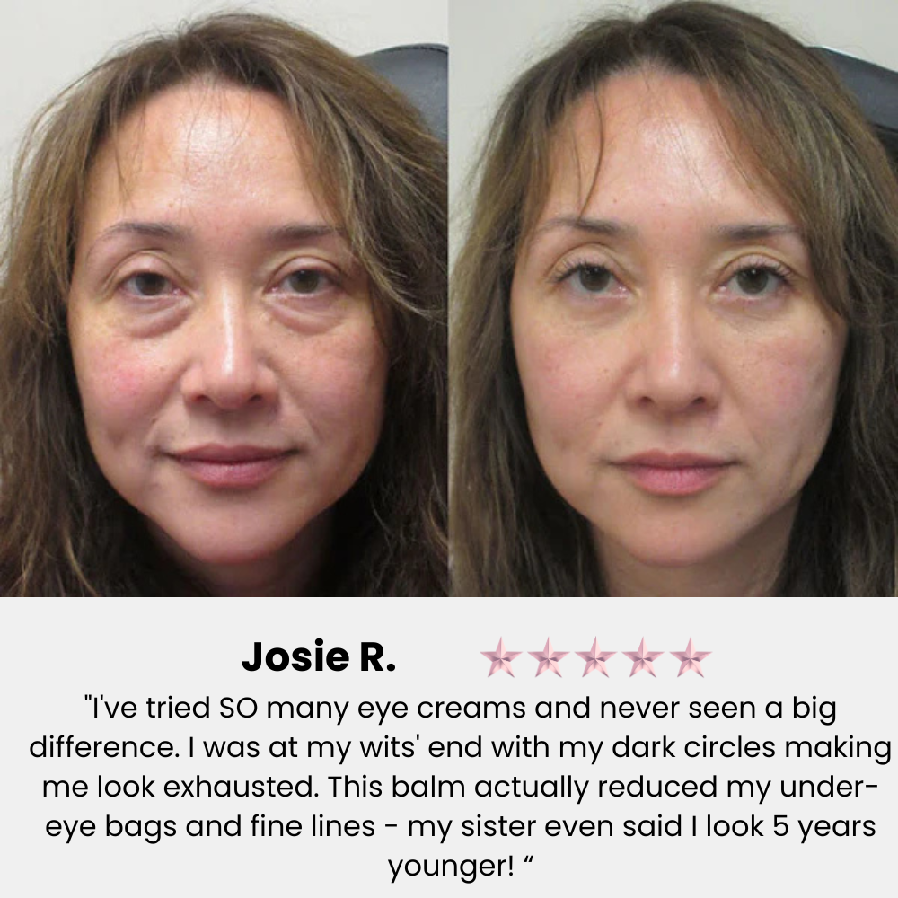 Klivora Revitalizing Under Eye Balm for Dark Circles, Puffiness & Fine Lines