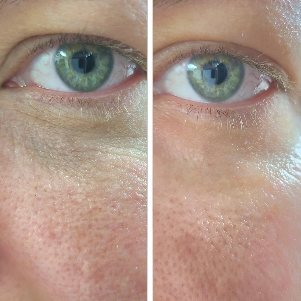 Advanced Volufiline Deep Collagen Serum for Face: Firming, Hydrating, Youthful Glow